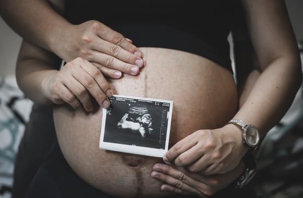 Pregnant Woman With Ultrasound Against Bump